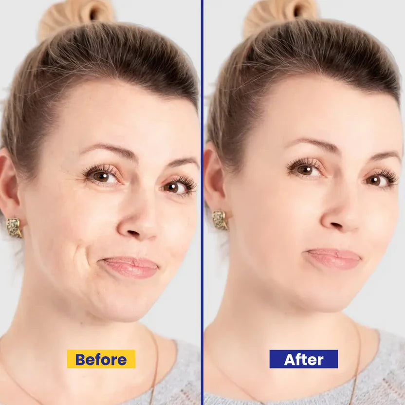 5-in-1 Face Beauty Cream Serum Soap Anti-Aging Brightening With Arbutin Vitamin Kojic Acid & Glutathione