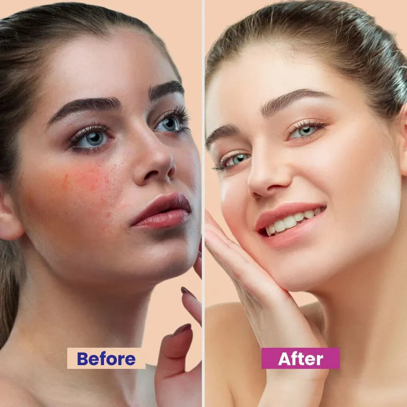 Max Hydration Goldish Anti Aging Beauty Cream Brightening & Hydrating Formula With Vitamin B6 & Arbutin