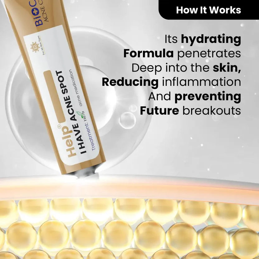 Anti Acne Cream Ffor Blemishes Scars & Breakouts Hydrating Formula With Aloe Vera & Neem Anti-Inflammatory