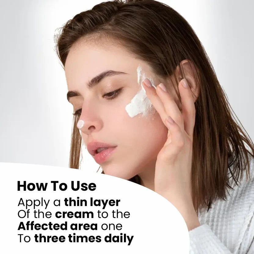 Anti Acne Cream Ffor Blemishes Scars & Breakouts Hydrating Formula With Aloe Vera & Neem Anti-Inflammatory