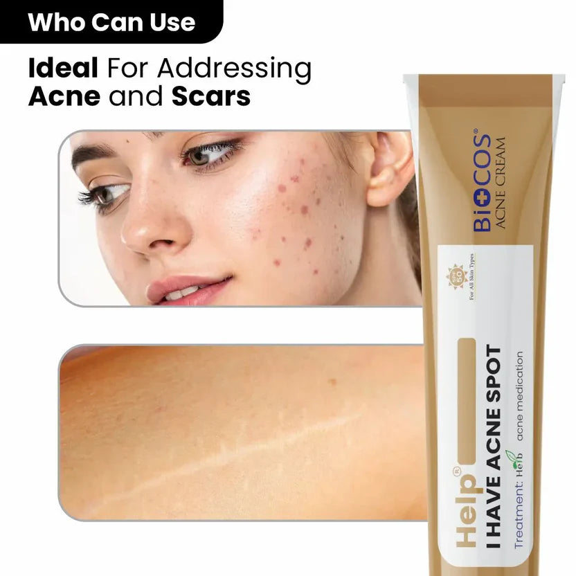 Anti Acne Cream Ffor Blemishes Scars & Breakouts Hydrating Formula With Aloe Vera & Neem Anti-Inflammatory