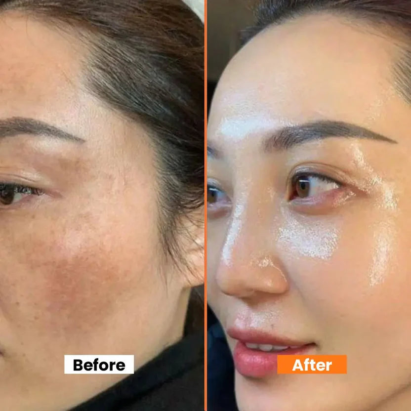 Dark Spot Correcting Face Cream Brightening & Hydrating Formula Fades Dark Spots Pigmentation & Uneven Skin Tone