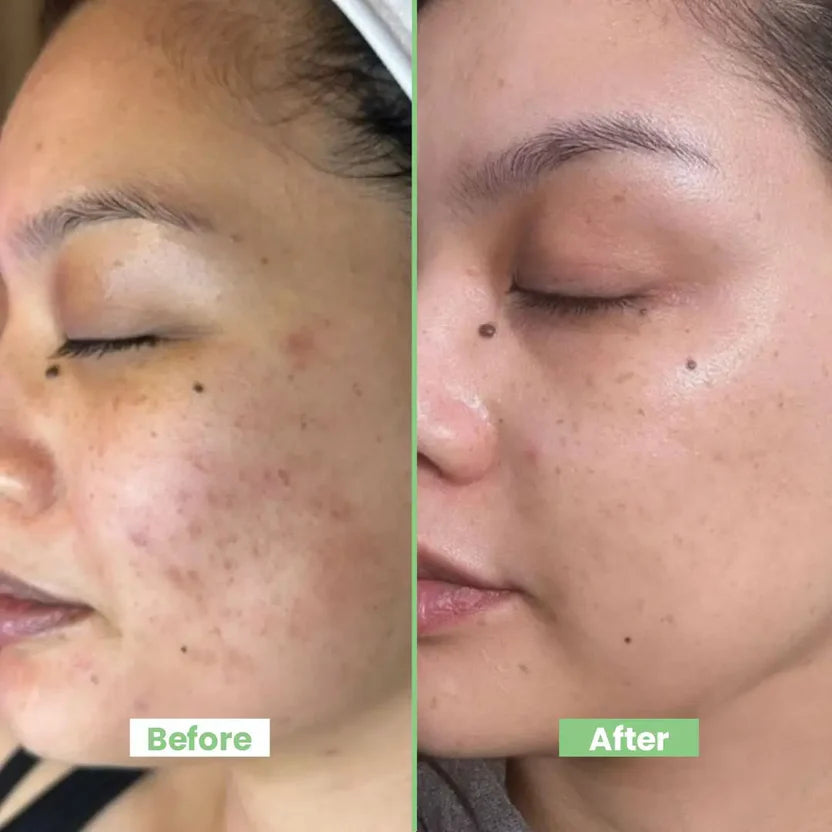 Arbutin Beauty Cream Dark Spot Corrector & Skin Tone Smoothing Cream With Kojic Acid & Vitamin B5