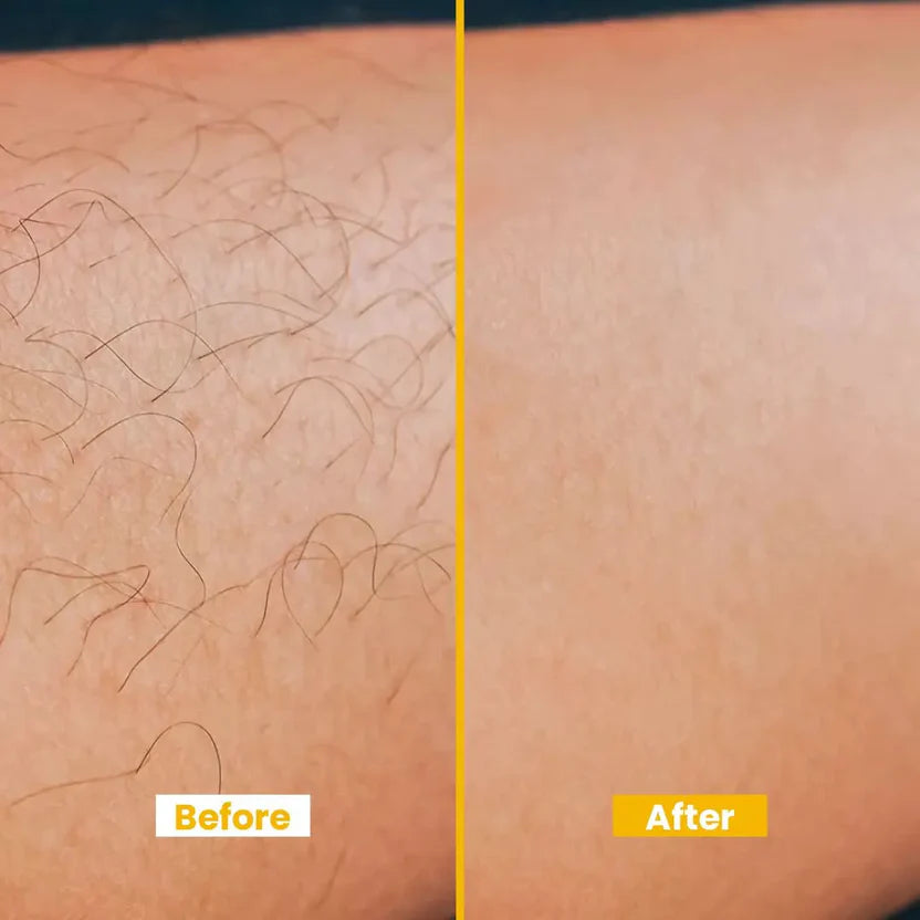 Lemon Hair Removal Cream With Vitamin E Moisturising Formula