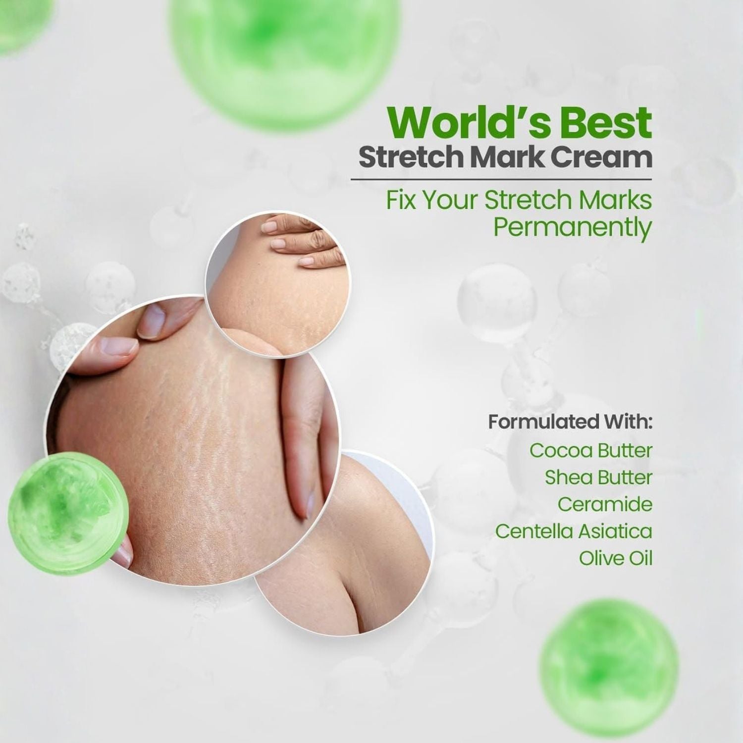 BIOCOS Stretch Marks Pregnancy Maternity Skin Care Cream – After Birth Belly Scars, Firm Skin with Shea Butter