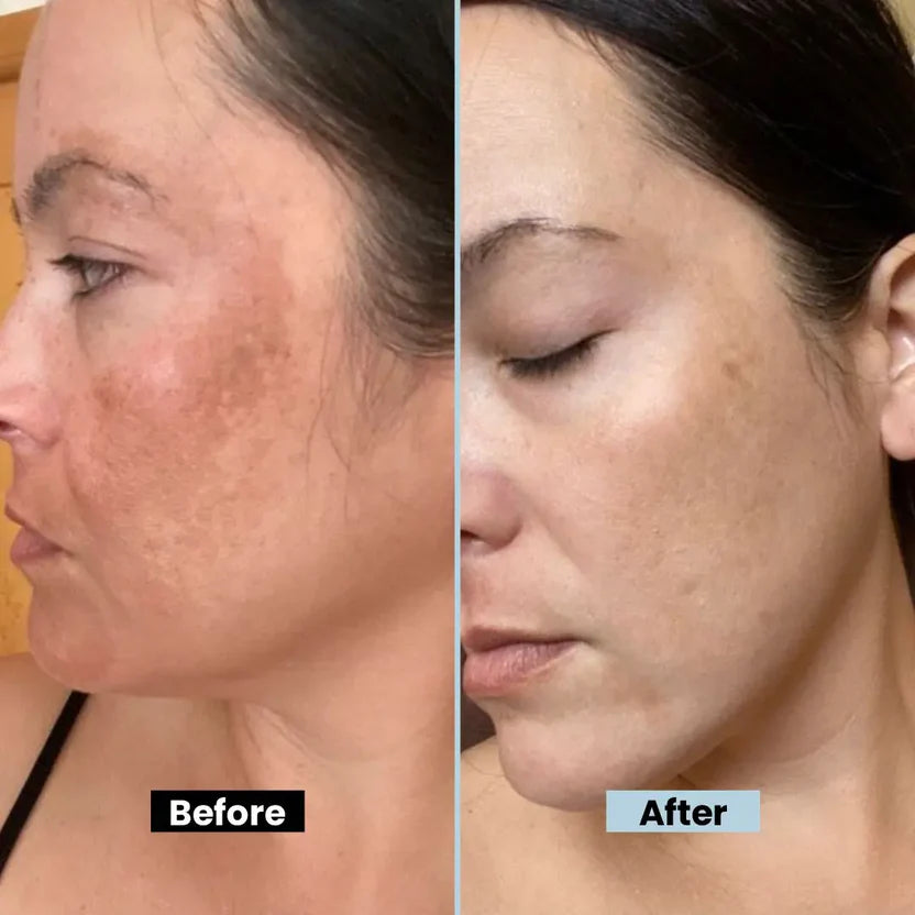 Glutathione Beauty Face Cream Brighten Skin With Aloe Vera & Hyaluronic Acid