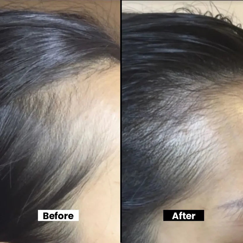 Anti-Hair Loss Shampoo with Coco Glucoside For Natural Hair Growth & Dandruff Control With British Technology for Fuller & Healthier Hair